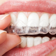 Illustration for article titled Throw Out Your Toothbrush, Artificial Enamel Is on the Way